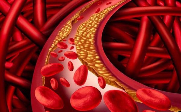 Sử dụng tinh dầu thông đỏ thường xuyên giúp giảm mỡ máu, lưu thông khí huyết.